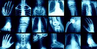 Sri Santhi Hospitals